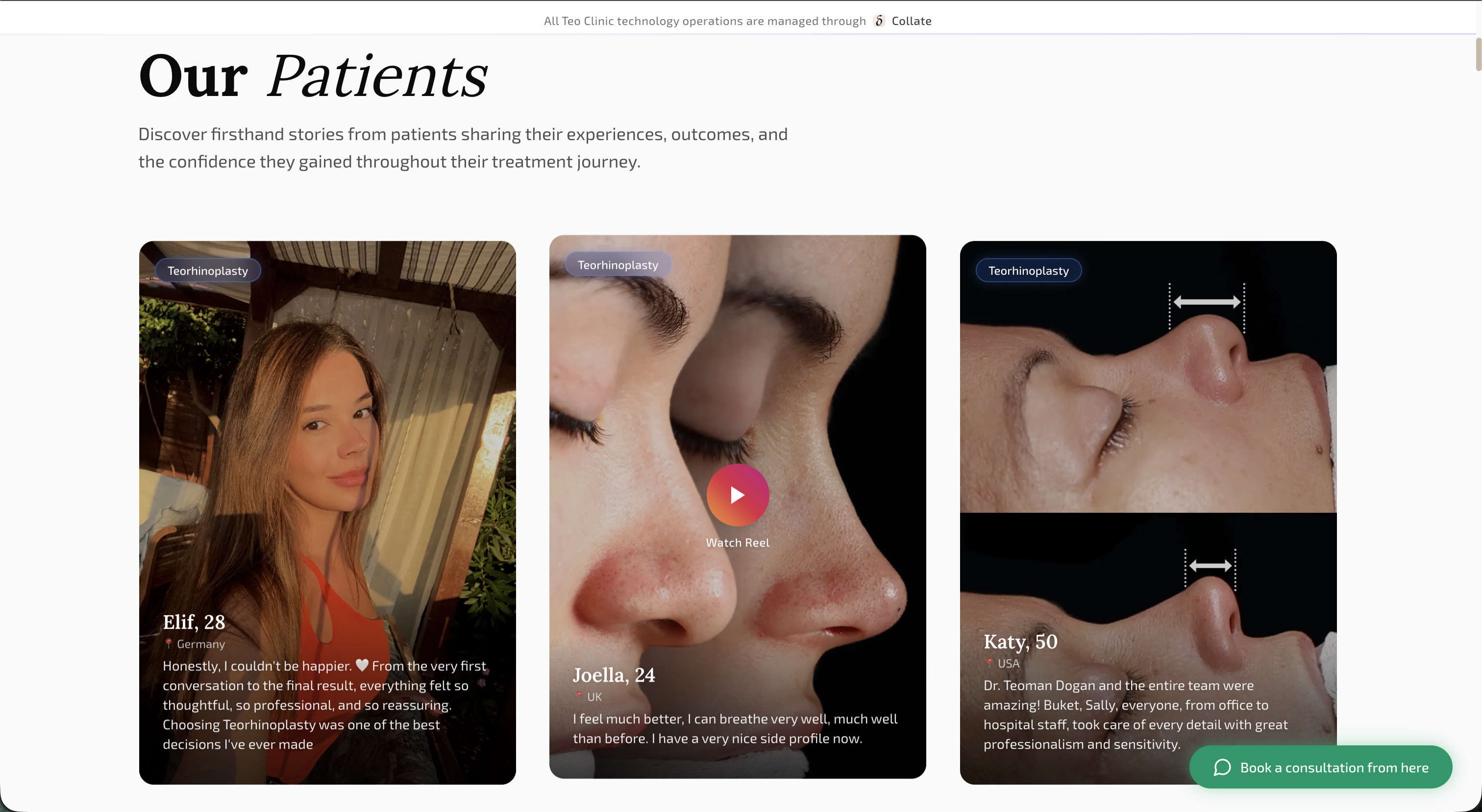 Teo Clinic website patient testimonials section showing rhinoplasty patient stories and outcomes